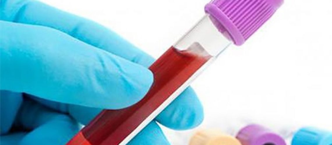 AMH_Testt-min