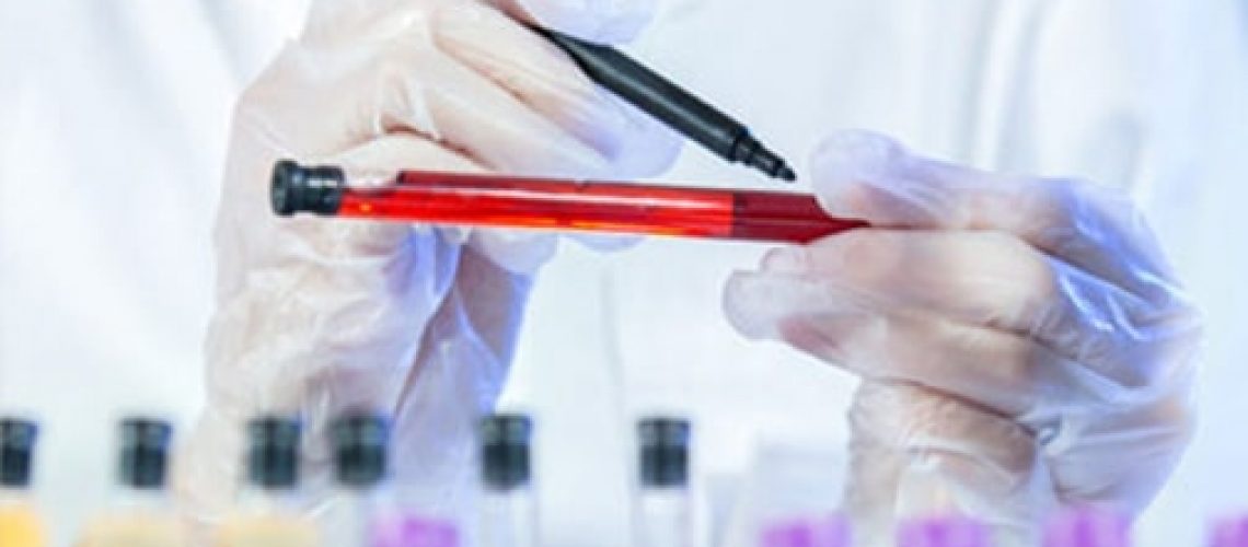 laboratorijske-pretrage-u-trudnoci-min