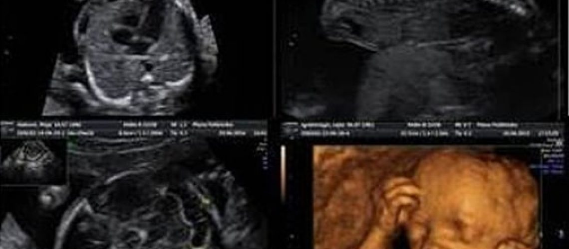 organ_screening-min