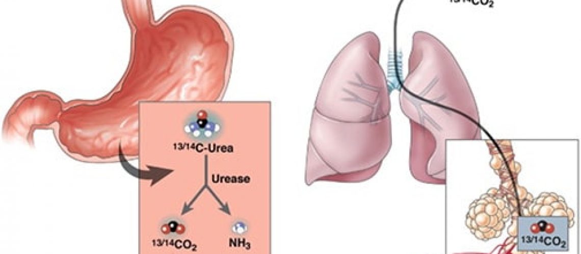 urea_breath_test0-min